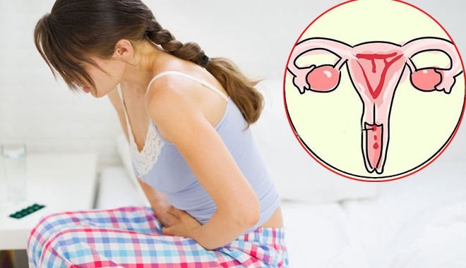 Nhiễm khuẩn âm đạo-Người phụ nữ nào cũng có thể mắc Nhiễm khuẩn âm đạo có thể gây ung thư cổ tử cung | Antican.vn