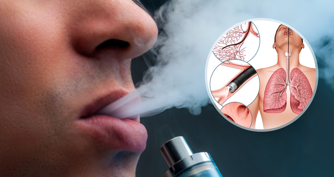 Thuốc lá điện tử gây tổn thương phổi và những tác hại khác cực kì nguy hiểm