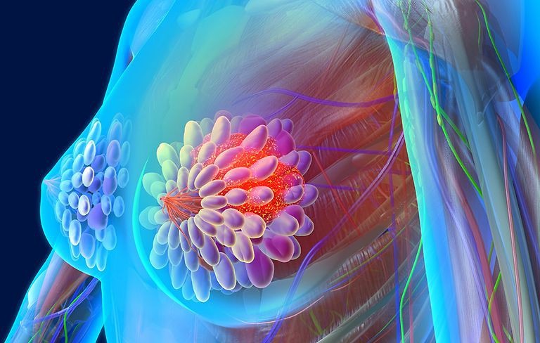 Phương pháp điều trị ung thư cho người cao tuổi Phương pháp điều trị ung thư cho người cao tuổi