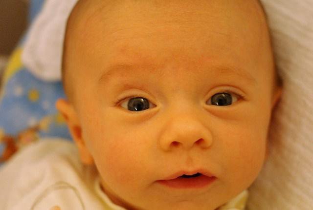 U nang ống mật chủ