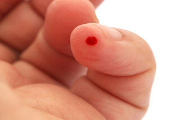 Thực hư về việc di truyền ung thư máu mà bạn chưa biết