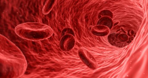 Tầm quan trọng của sức bền hồng cầu trong bệnh lý huyết sắc tố và thiếu máu tan máu Tầm quan trọng của sức bền hồng cầu trong bệnh lý huyết sắc tố và thiếu máu tan máu